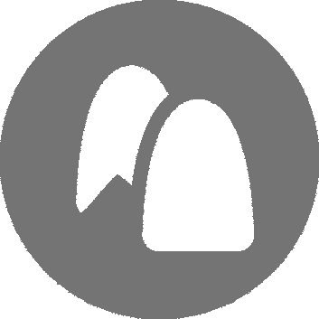 Composite Bonding